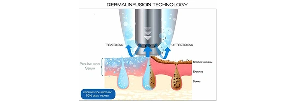 Hydrafacial-1