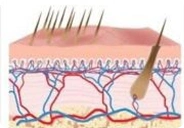 Niechciane-owłosienie