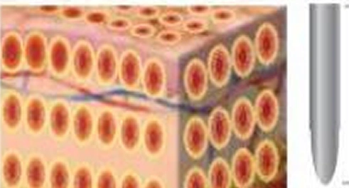 Obszar-docelowy-RF-naskórek