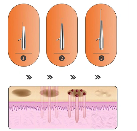 Sonda-laserowa-CO2